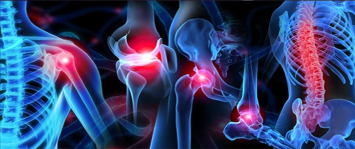 how-to-treat-knee-pain-causes-myths-and-management-youtube