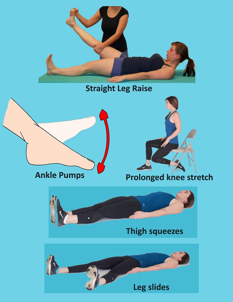 Printable Total Knee Replacement Exercises Pictures