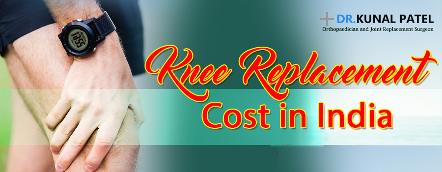 Knee replacement cost in India