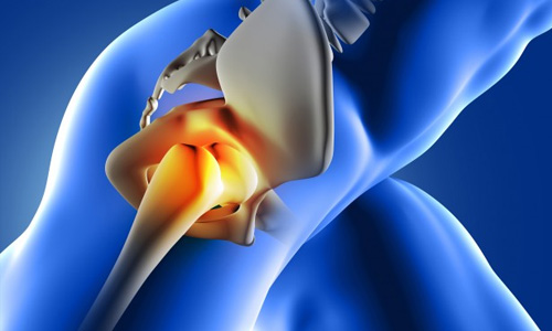 Best doctor for hip replacement Mumbai