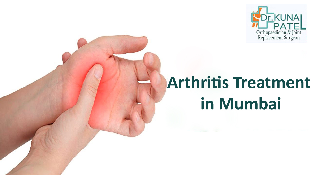 Arthritis Treatment Mumbai