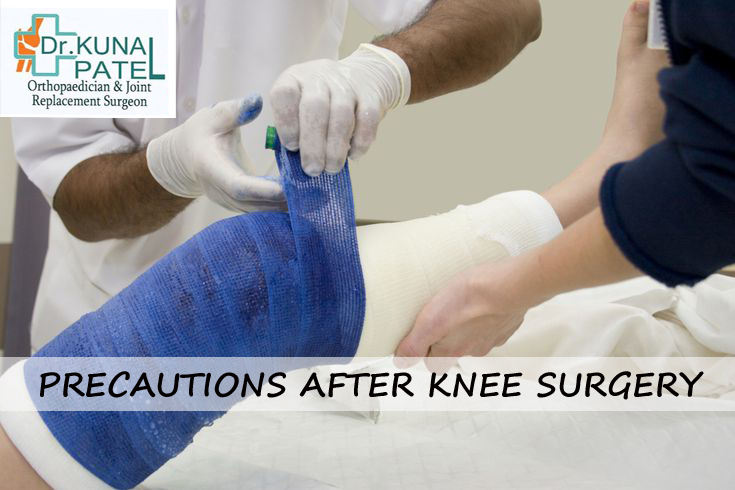 Precautions After Knee Surgery - Dr Kunal