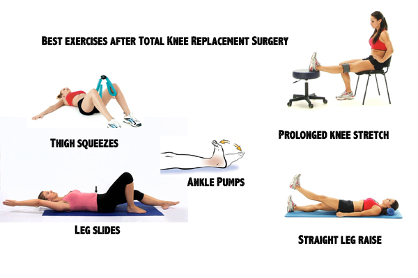 Best Exercises After Total Knee Replacement Surgery