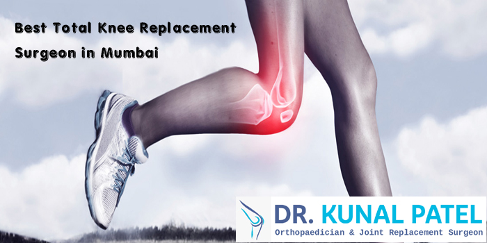 Best Total Knee Replacement Surgeon in Mumbai.