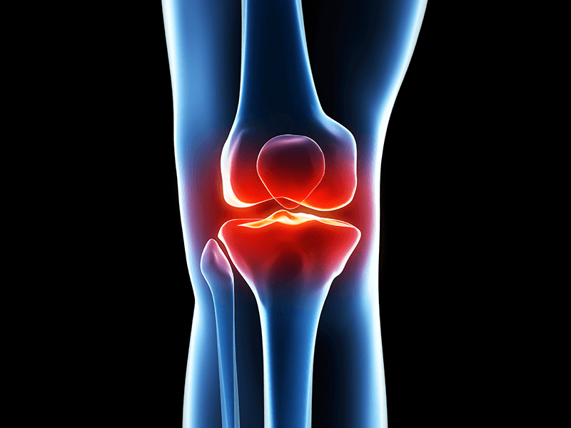 Best Joint Replacement Surgeon in Mumbai