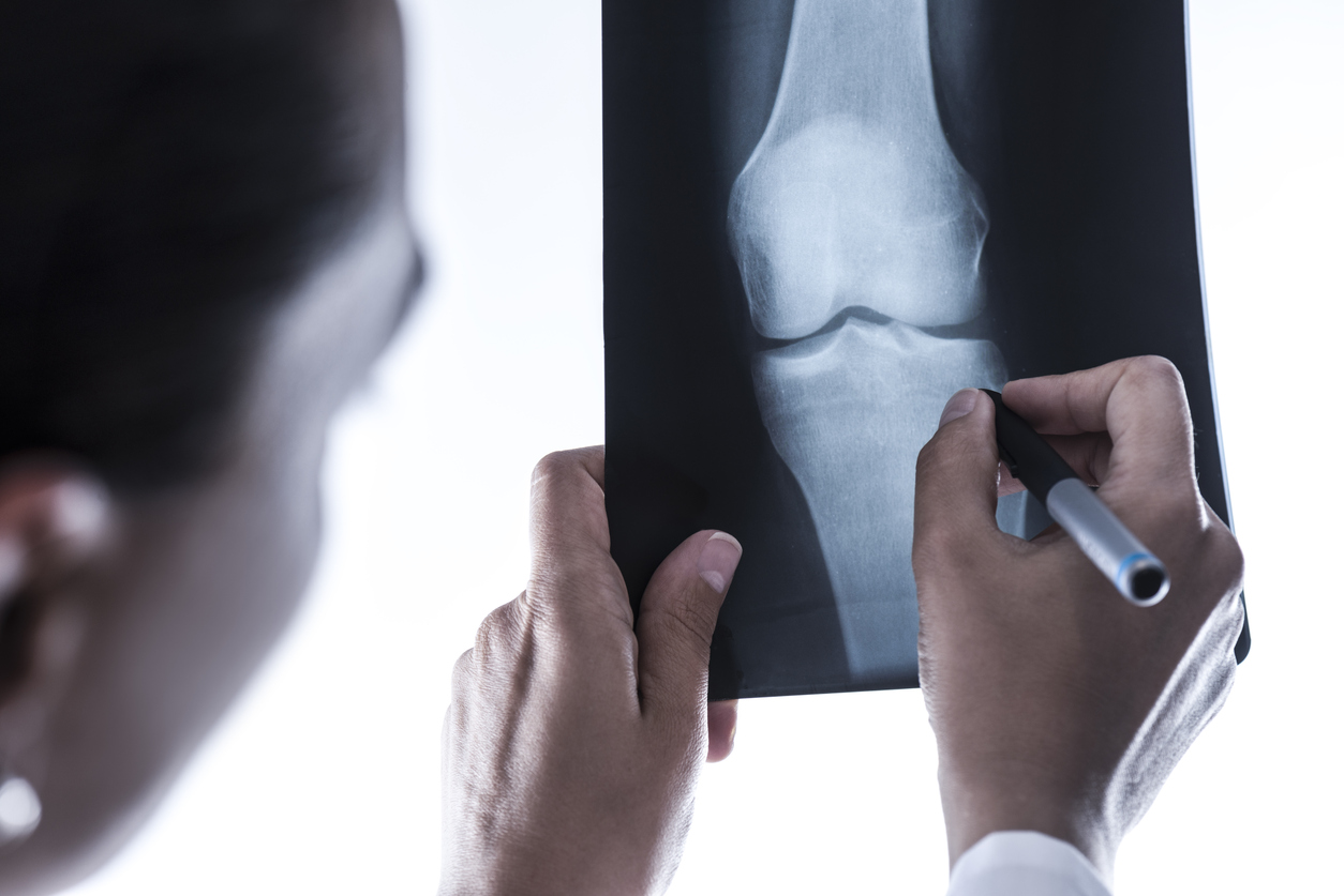 bone specialist in Mumbai