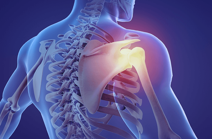 best shoulder arthroscopy surgeon in Mumbai