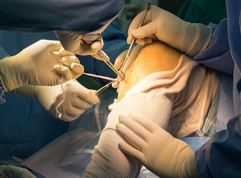 Joint Replacement Surgeon in Mumbai