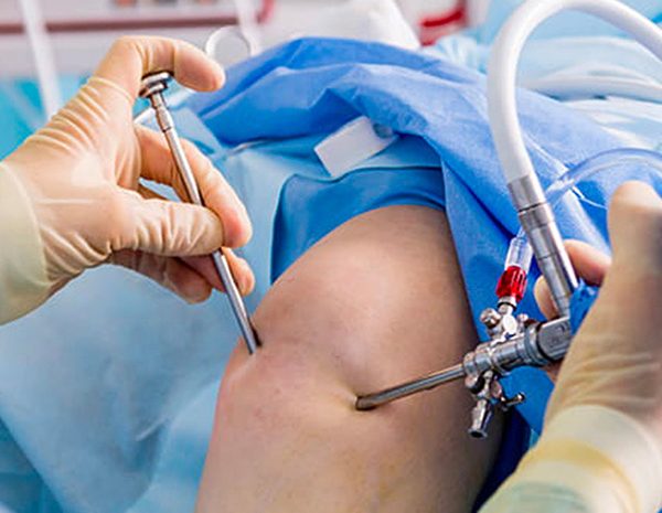 Best Orthopedic Surgeon for Knee Replacement in Mumbai