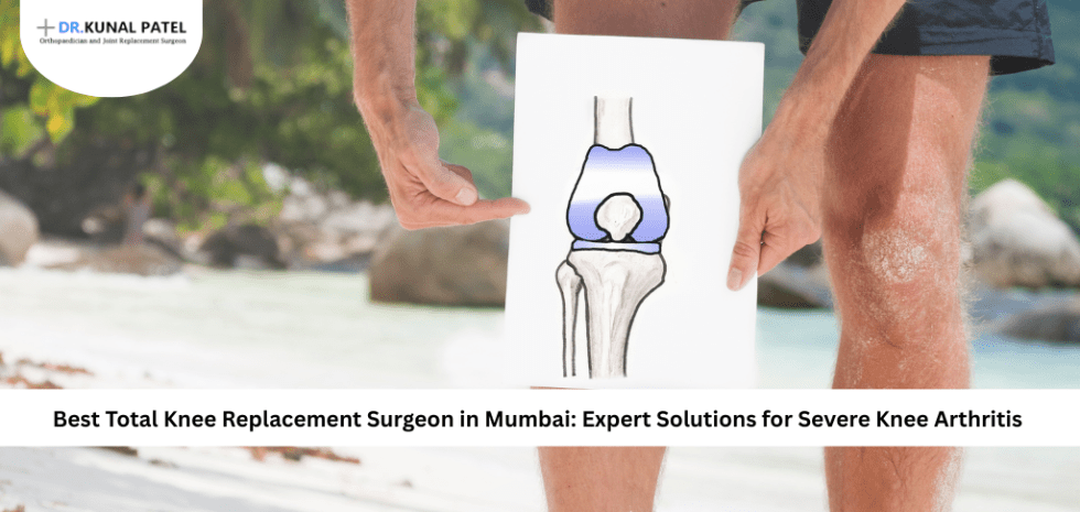Total Knee Replacement Surgeon in Mumbai
