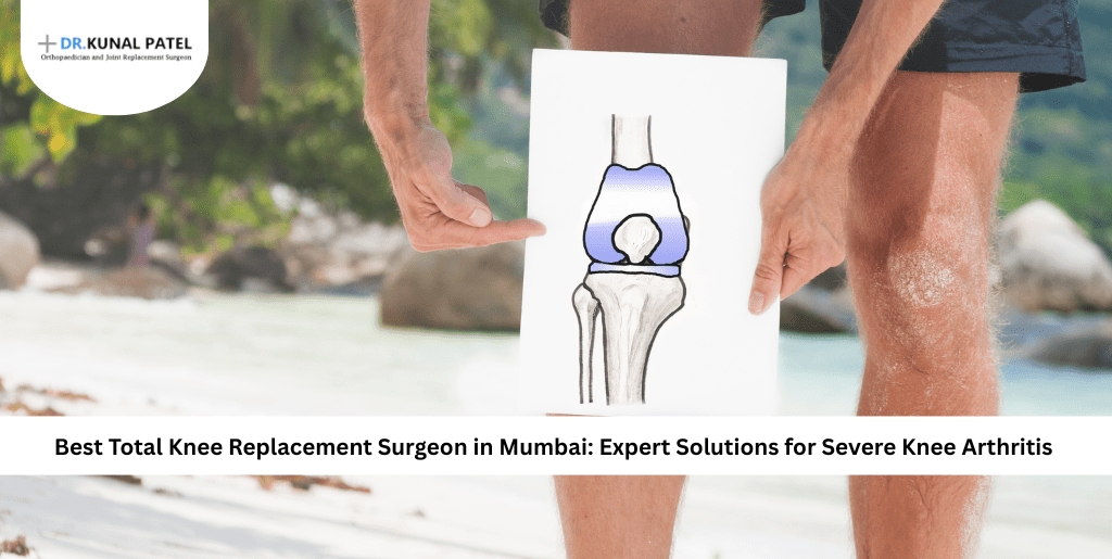 Total Knee Replacement Surgeon in Mumbai
